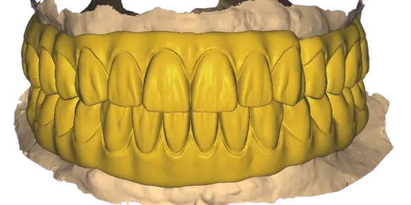 DentiSysDesign